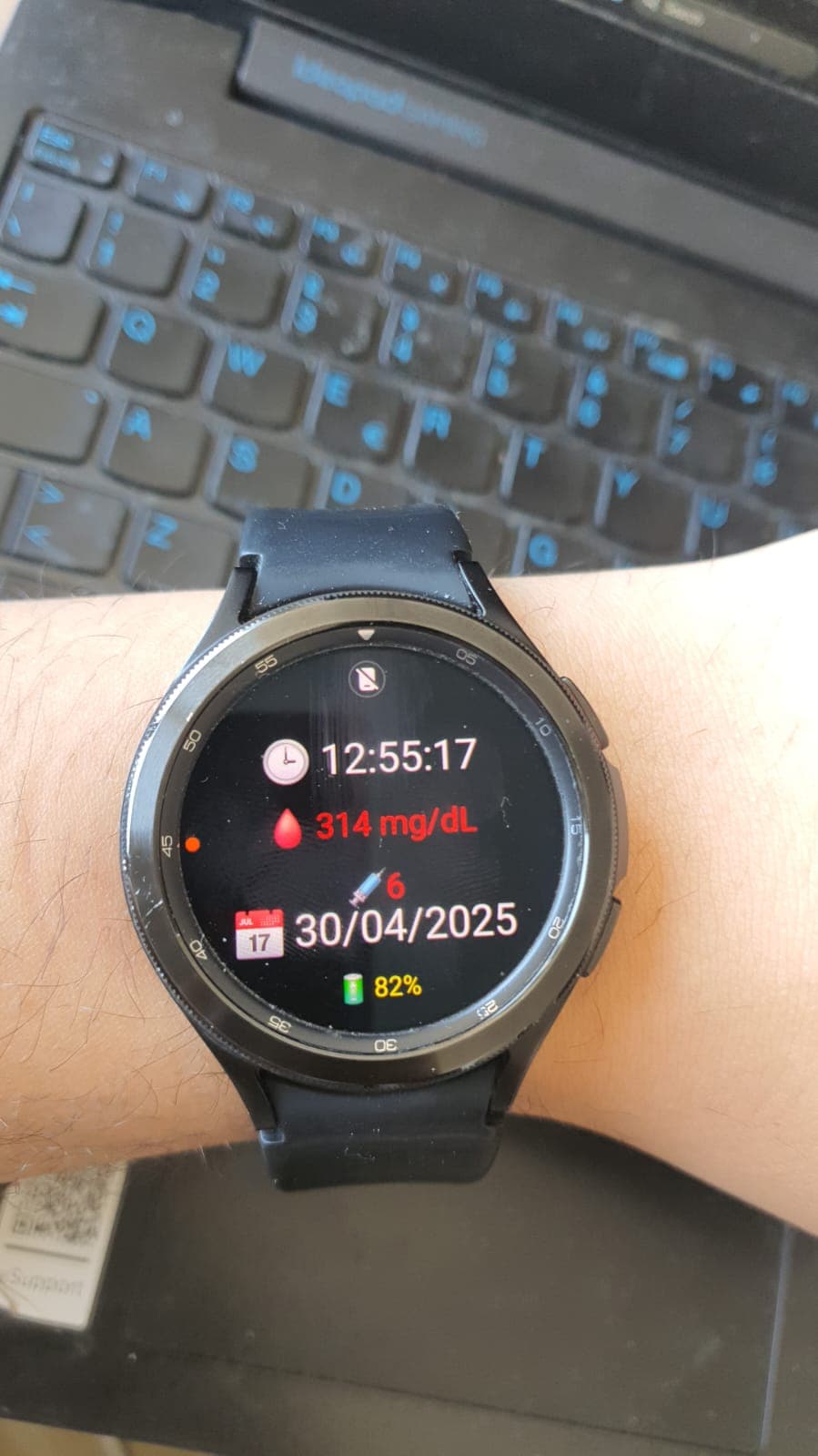 DiabetyFaceWatch - Glucose Watchface for Wear OS